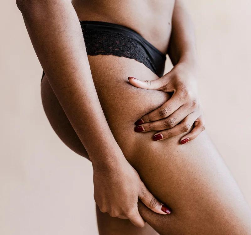 Top Natural Remedies For Hyperpigmentation On Inner Thighs: Tips & Treatments